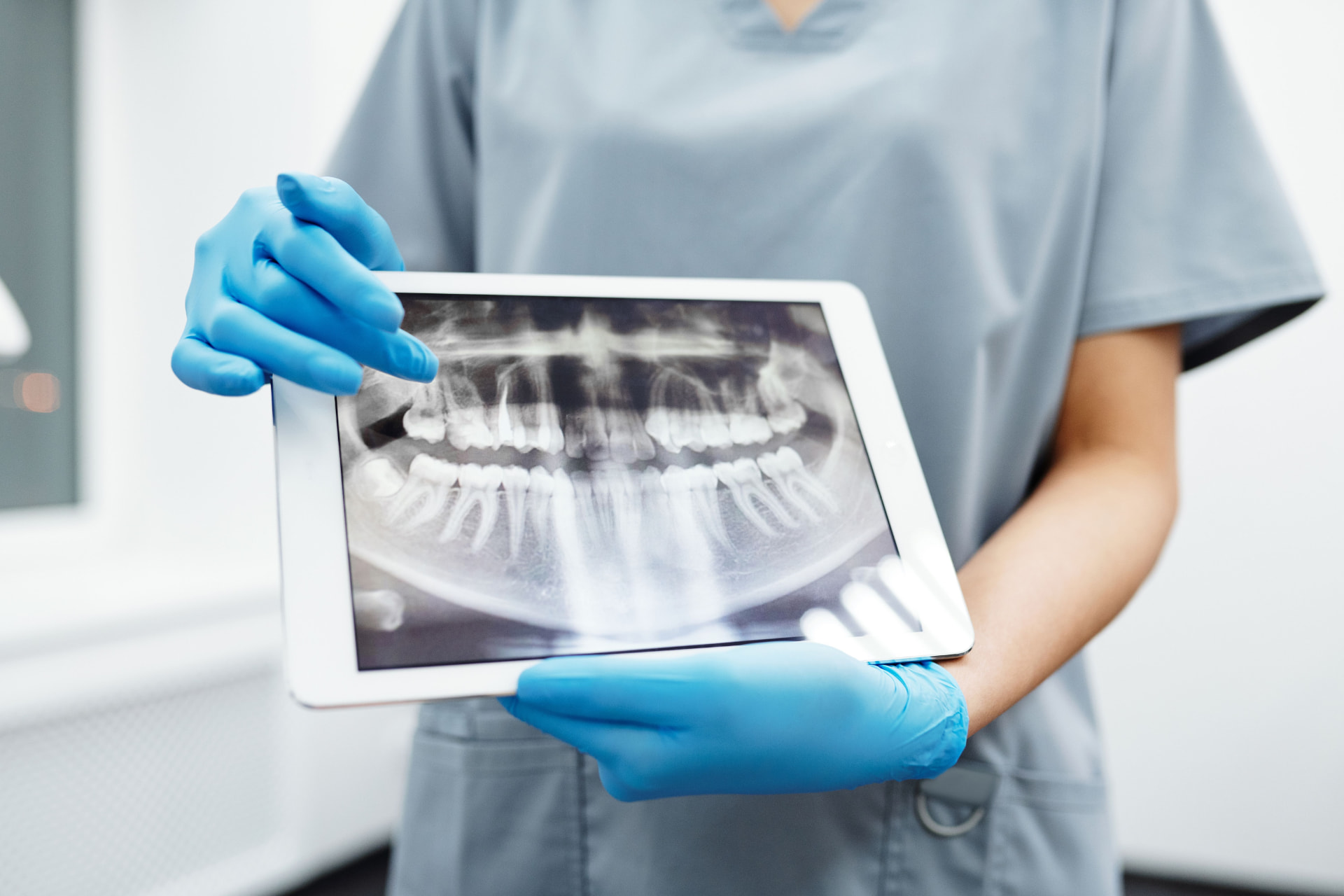 Radiografia panoramica mostrata durante una visita endodontica